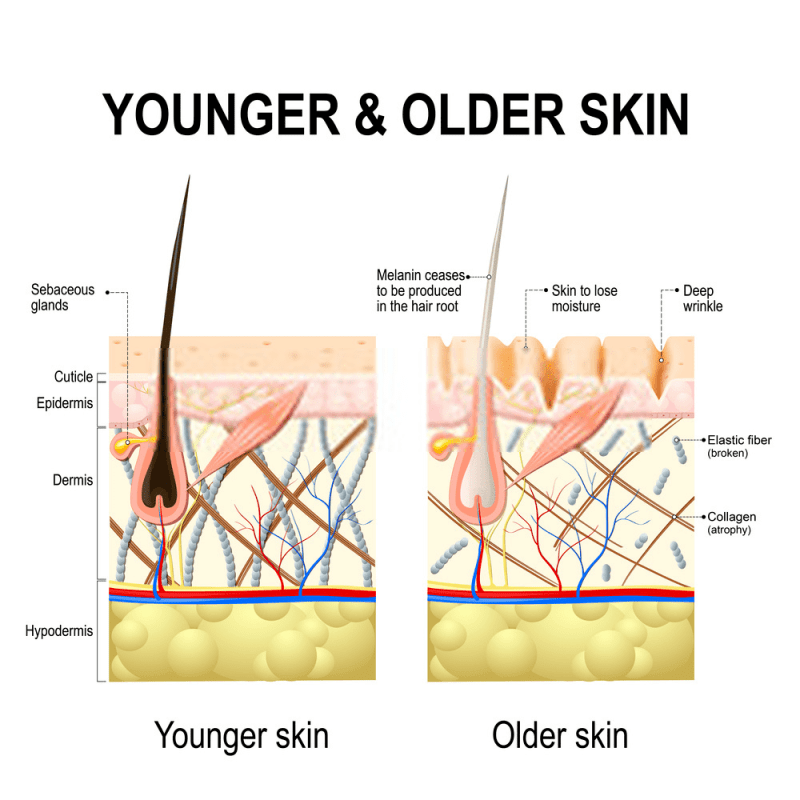 skin aging img refoem skincare