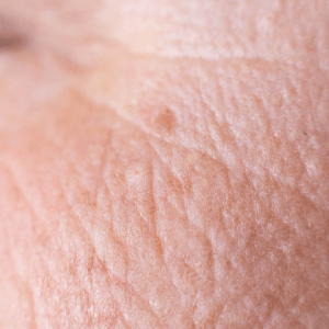 Anti-ageing